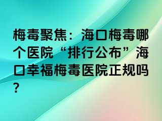 梅毒聚焦：海口梅毒哪个医院“排行公布”海口幸福梅毒医院正规吗?